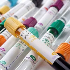 TUBO VACUTAINER